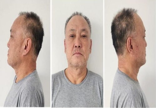 パク・チャンソン被告