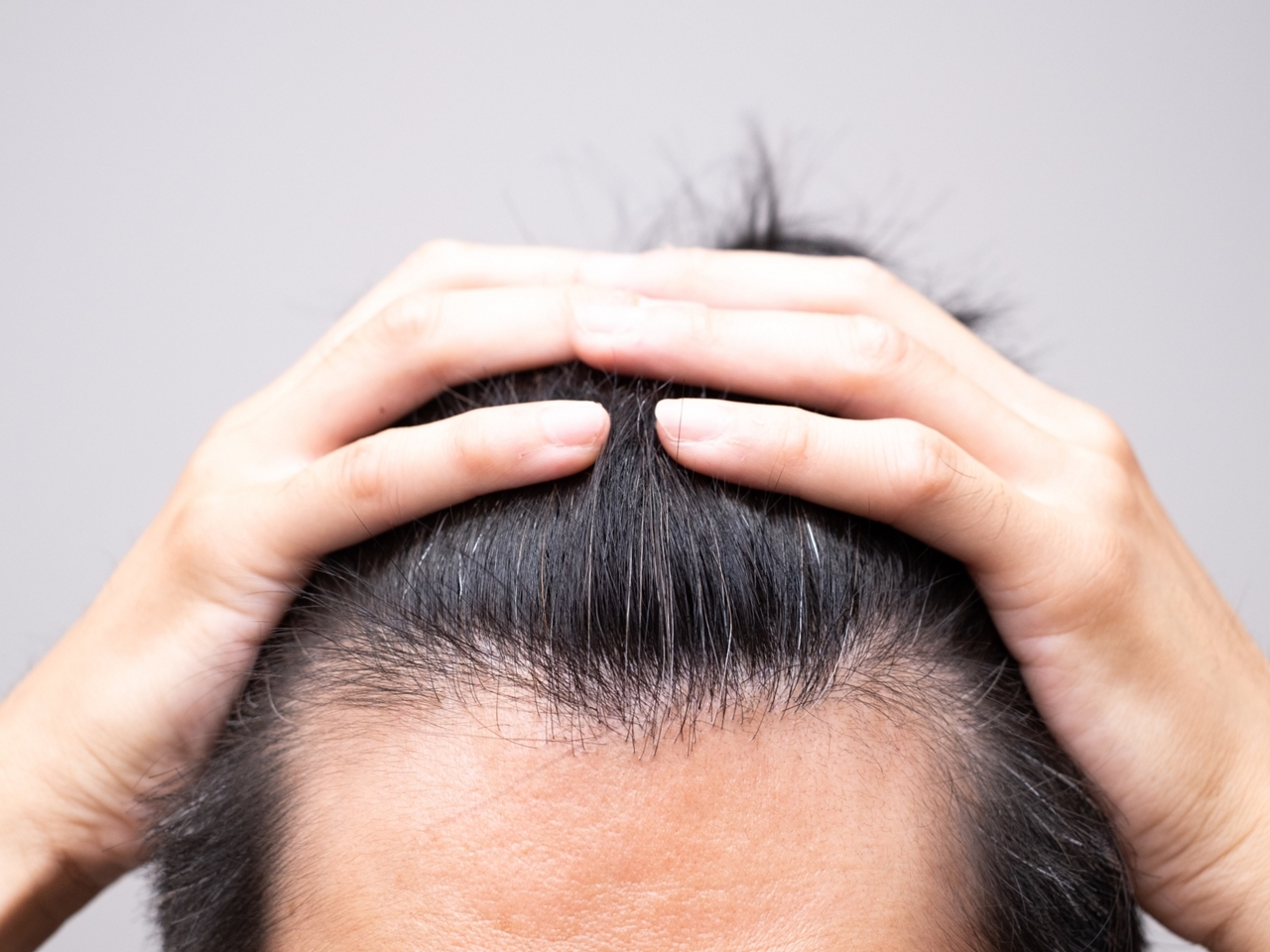 “奇跡の抜け毛治療薬”はウソだった…韓国で誇大広告を一斉摘発、当局「消費者に混乱与える恐れ」